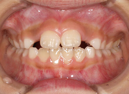 治療が必要なら始めたい